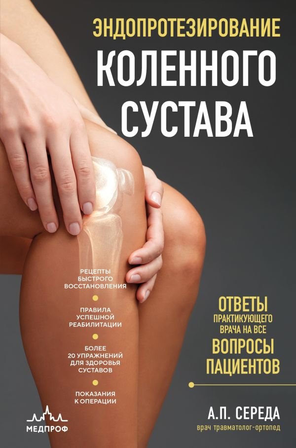 cover1__w600-17181 Эндопротезирование коленного сустава: ответы практикующего врача на все вопросы пациентов